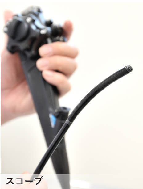 内視鏡検査スコープ