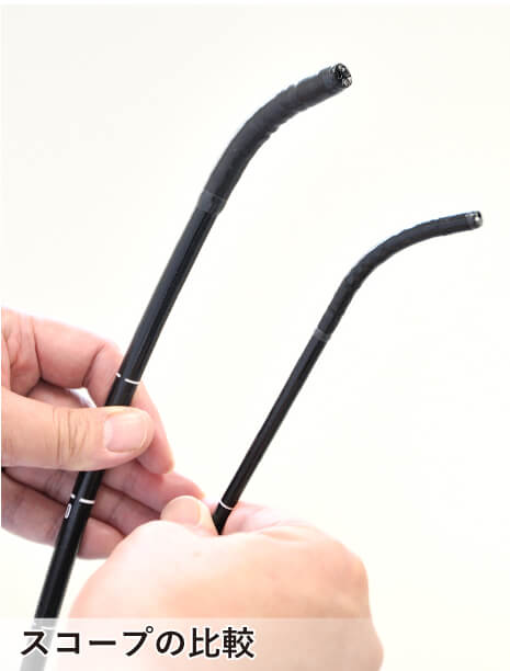 内視鏡検査スコープ